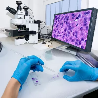 arhivare_casete_histologice